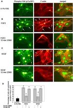 Phospho-VEGF Receptor 2 (Tyr1214) Antibody in Immunocytochemistry (ICC/IF)