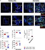 CD127 Antibody in Immunohistochemistry (IHC)