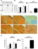 Phospho-Tau (Thr231) Antibody in Immunohistochemistry, ELISA (IHC, ELISA)