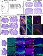 EOMES Antibody in Immunohistochemistry (IHC)