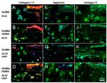 Collagen X Antibody in Immunocytochemistry, Immunohistochemistry (ICC/IF, IHC)