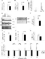 Caspase 1 Antibody in Western Blot (WB)