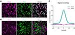 GFAP Antibody in Immunocytochemistry, Immunohistochemistry (ICC/IF, IHC)