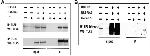 TLR5 Antibody in Western Blot, Immunoprecipitation (WB, IP)