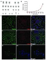 Nestin Antibody in Immunocytochemistry (ICC/IF)