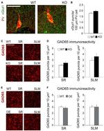 VGLUT1 Antibody in Immunohistochemistry (IHC)