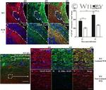 CD3 Antibody in Immunohistochemistry (IHC)