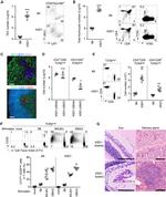 AIRE Antibody in Immunohistochemistry (IHC)