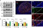 CD20 Antibody in Immunohistochemistry (IHC)