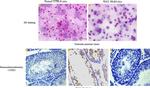 CD20 Antibody in Immunohistochemistry (IHC)