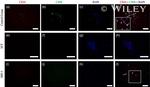 CD34 Antibody in Immunocytochemistry (ICC/IF)