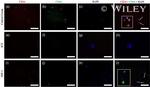 CD44 Antibody in Immunocytochemistry (ICC/IF)