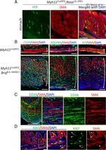 CD140a (PDGFRA) Antibody in Immunohistochemistry (IHC)