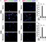 CD45 Antibody in Immunocytochemistry (ICC/IF)