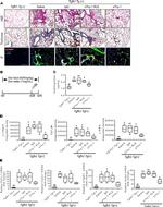 CD51 (Integrin alpha V) Antibody in Immunohistochemistry (IHC)