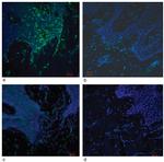 CD56 (NCAM) Antibody in Immunohistochemistry (IHC)