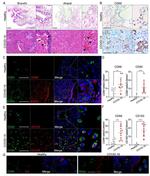 CD68 Antibody in Immunohistochemistry (IHC)