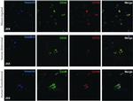 CD105 (Endoglin) Antibody in Immunocytochemistry (ICC/IF)