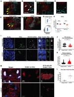 mCherry Antibody in Immunocytochemistry (ICC/IF)