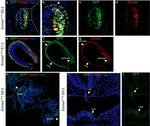 EOMES Antibody in Immunocytochemistry (ICC/IF)