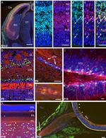 EOMES Antibody in Immunohistochemistry (IHC)