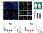 EOMES Antibody in Immunohistochemistry (IHC)