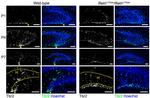 EOMES Antibody in Immunohistochemistry (IHC)