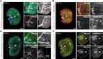 Podoplanin Antibody in Immunocytochemistry (ICC/IF)