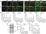 Ki-67 Antibody in Immunohistochemistry (IHC)