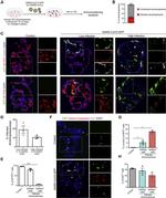 SFTPB Antibody in Immunohistochemistry (IHC)