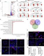 SARS Coronavirus Nucleocapsid Antibody in Immunohistochemistry (IHC)