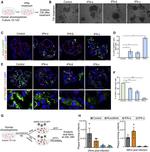 SFTPB Antibody in Immunohistochemistry (IHC)