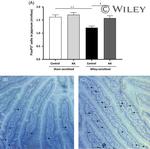 FOXP3 Antibody in Immunohistochemistry (Paraffin) (IHC (P))