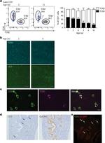 CD326 (EpCAM) Antibody in Immunohistochemistry (IHC)