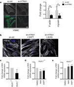 Smooth Muscle Myosin Antibody in Immunocytochemistry (ICC/IF)