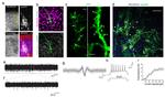 Synaptophysin Antibody in Immunocytochemistry (ICC/IF)