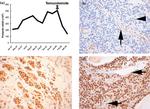 MGMT Antibody in Immunohistochemistry (IHC)