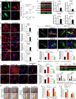 Alpha-Smooth Muscle Actin Antibody in Immunocytochemistry (ICC/IF)