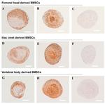 Collagen X Antibody in Immunohistochemistry (IHC)