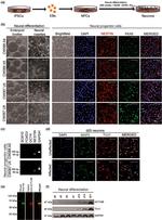 Nestin Antibody in Immunocytochemistry (ICC/IF)