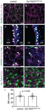 FOXJ1 Antibody in Immunohistochemistry (IHC)