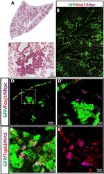 FOXJ1 Antibody in Immunohistochemistry (IHC)