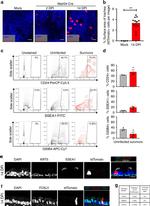 FOXJ1 Antibody in Immunohistochemistry (IHC)