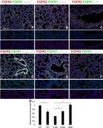 FOXJ1 Antibody in Immunohistochemistry (IHC)