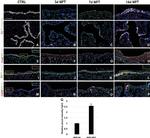 FOXJ1 Antibody in Immunohistochemistry (IHC)