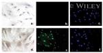 VDR Antibody in Immunocytochemistry (ICC/IF)