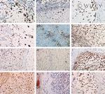 COX2 Antibody in Immunohistochemistry, Immunohistochemistry (Paraffin) (IHC, IHC (P))