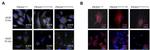 Clathrin Heavy Chain Antibody in Immunocytochemistry (ICC/IF)