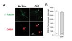 alpha Tubulin Antibody in Immunocytochemistry (ICC/IF)