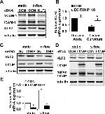 TXNIP Antibody in Western Blot (WB)